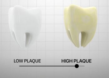 Bryan Johnson Teeth Plaque Index